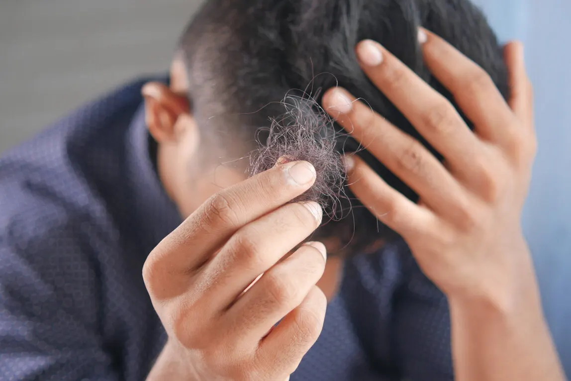 Haarverlies
